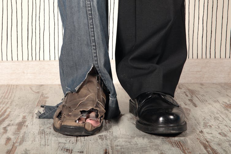 Man with one shiny shoe and one scruffy shoe